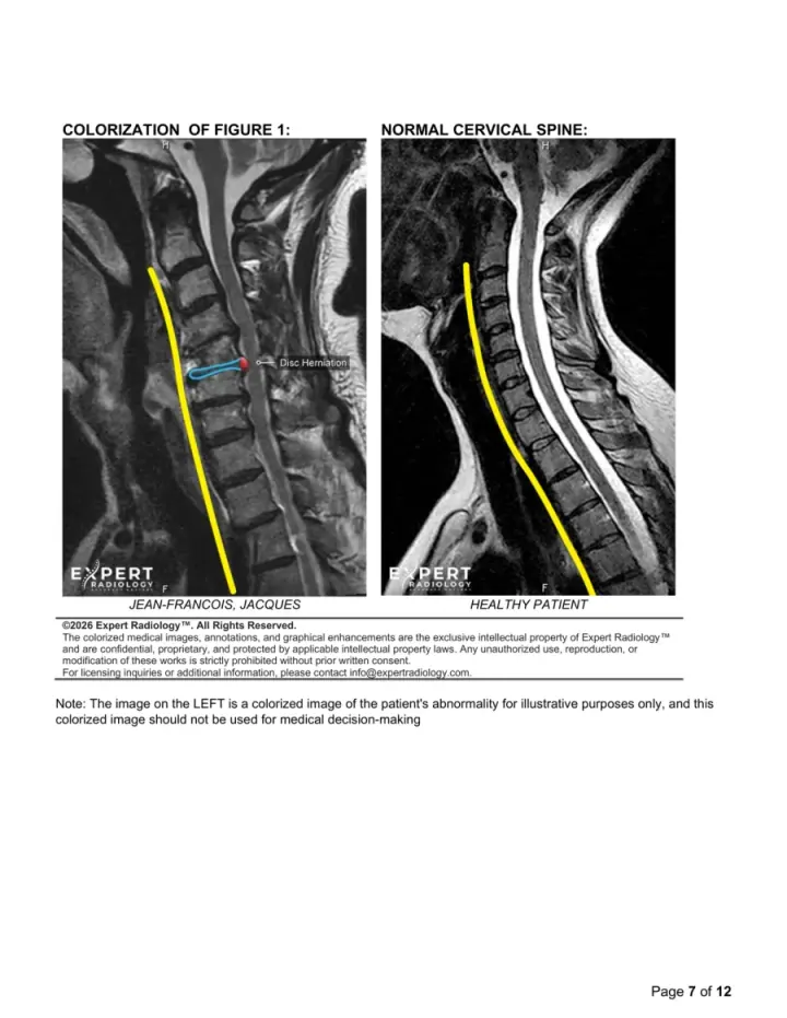 PrecisionPlus report page with a color comparison and reference anatomy